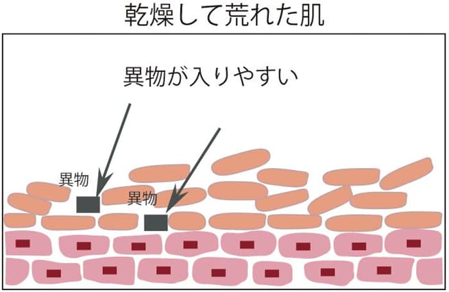 乾燥して荒れた肌